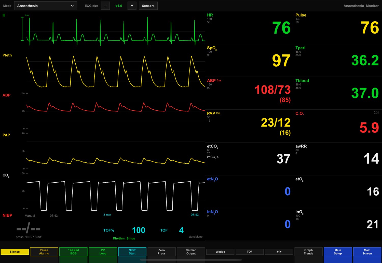 Patient Monitor — Anaesthesia